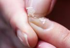 Zašto se nokti često lome i što je to?